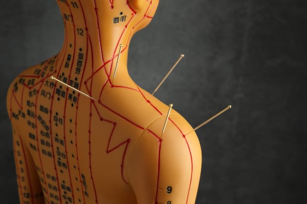 Acupuncture points